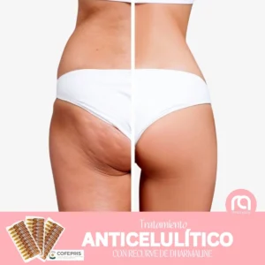 TRATAMIENTO ANTICELULÍTICO DHARMALINE con RECURVE
